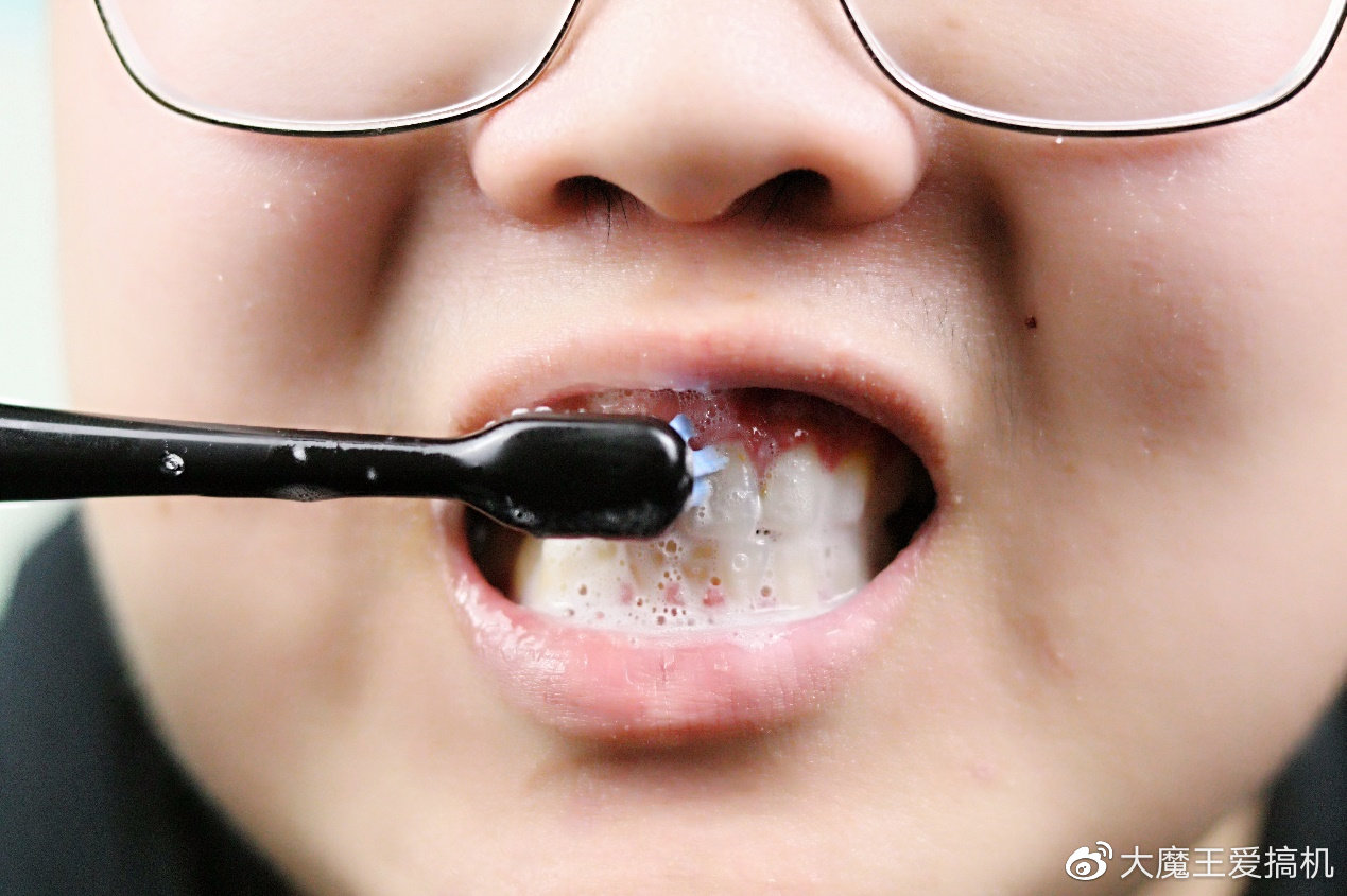 黑科技抗敏感牙膏,黑科技牙膏让烂牙齿变白