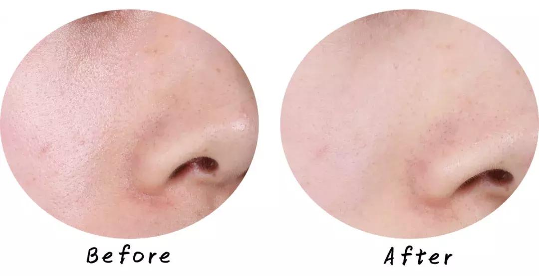 最好用清洁面膜排行榜前十名图片,公认最好用的清洁面膜混油皮