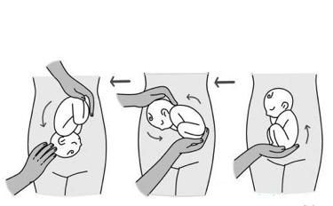 难产按肚子伸手转胎位,孕期34周可以手转胎位吗