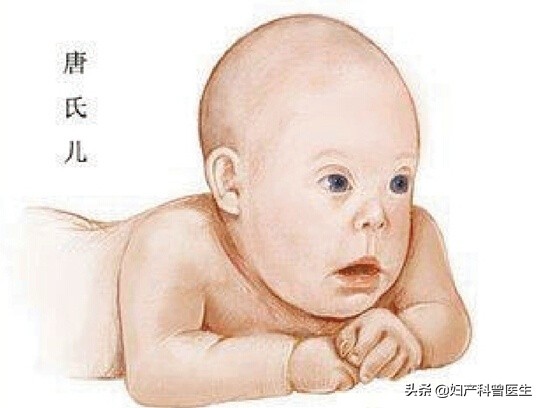 孕期B超检查做多了会引起胎儿畸形?做几次合适,需要注意什么?