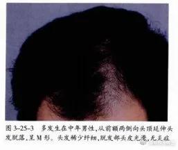 自我剖析问题原因和整改措施,自我诊断原因分析及改进措施