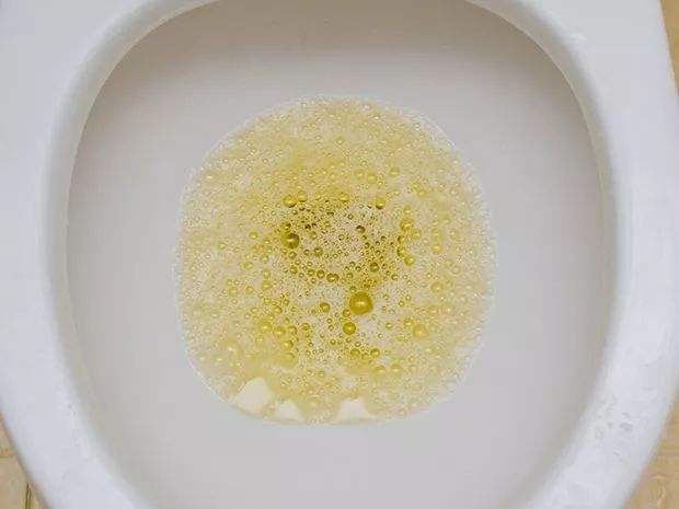 肾病上厕所次数突然变多,肾病吃甲泼尼龙上厕所多