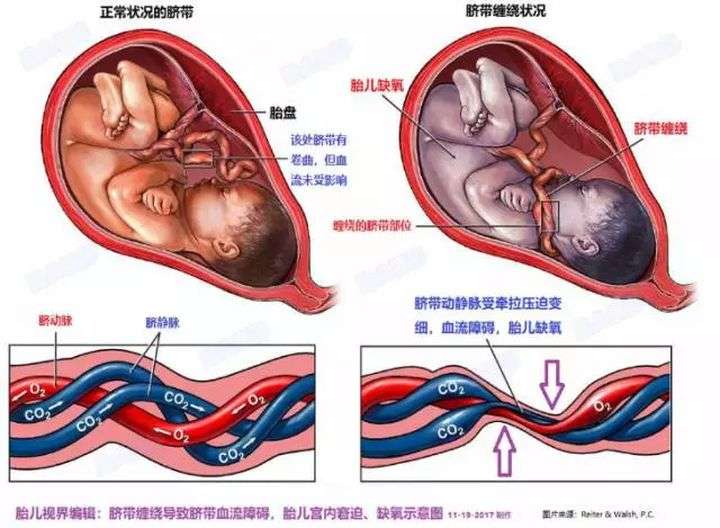 你竟是喝着自己的尿液长大的,在母亲体内,你都经历了什么?