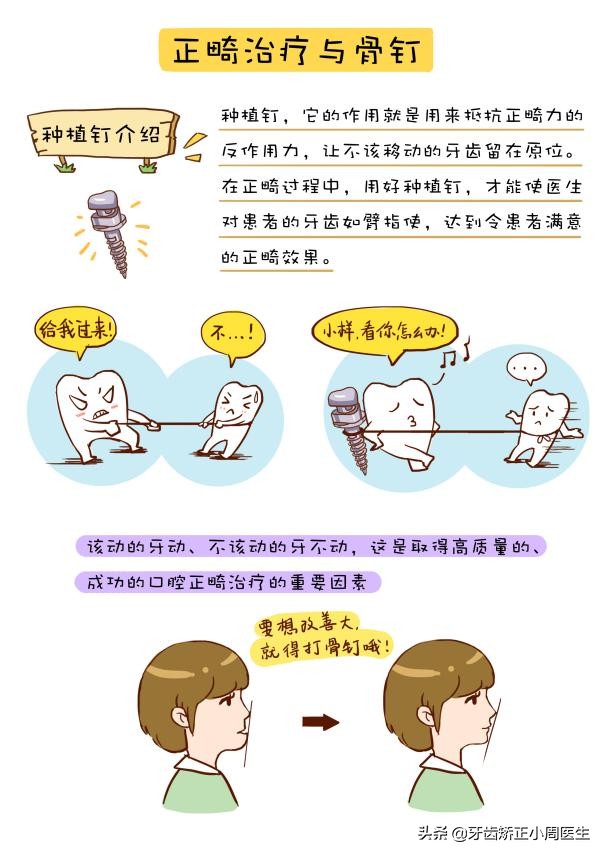 正畸牙齿打骨钉的危害,正畸打骨钉是什么感觉
