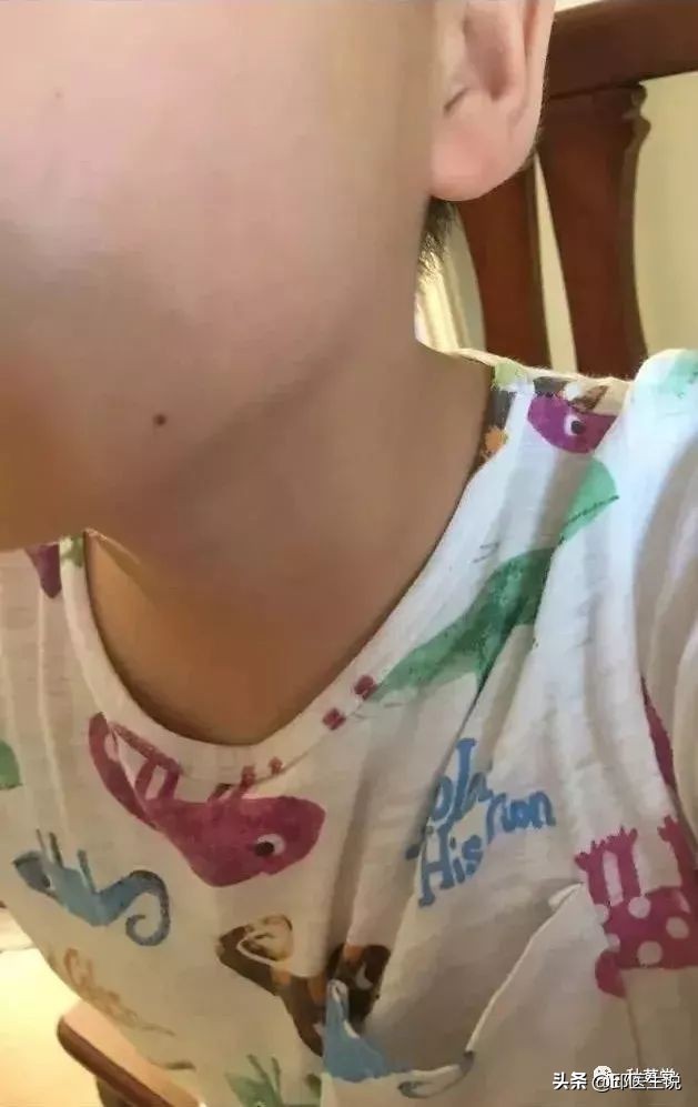 中医认为皮肤瘙痒是什么原因,治疗皮肤瘙痒的偏方医案