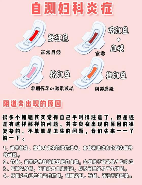 注意哪五个生活细节能预防盆腔炎,霉菌性阴道炎最怕三个症状