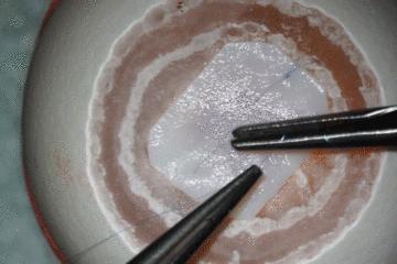 医学缝针练习,医生如何练习缝针