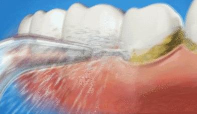 牙科诊所里你不知道的事,口腔医生提醒