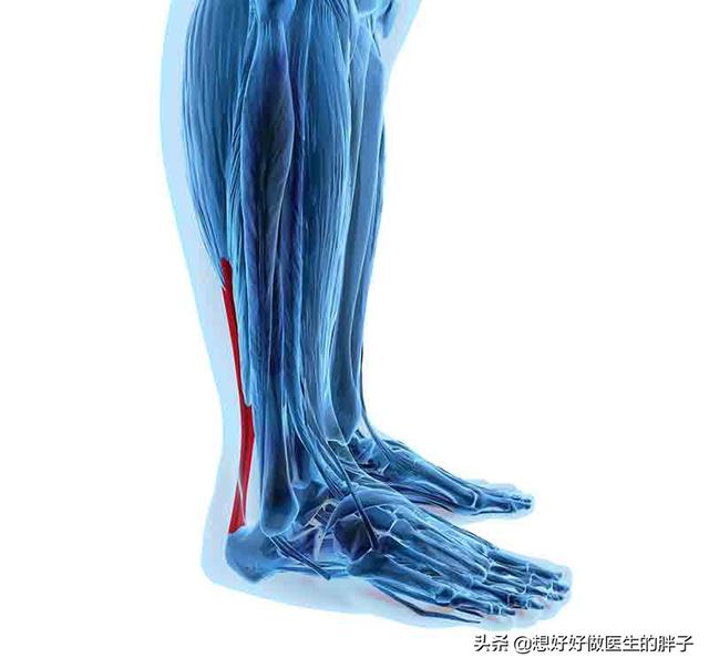 跑步引起脚后跟痛怎么办,跑步引起脚后跟部韧带疼怎么办