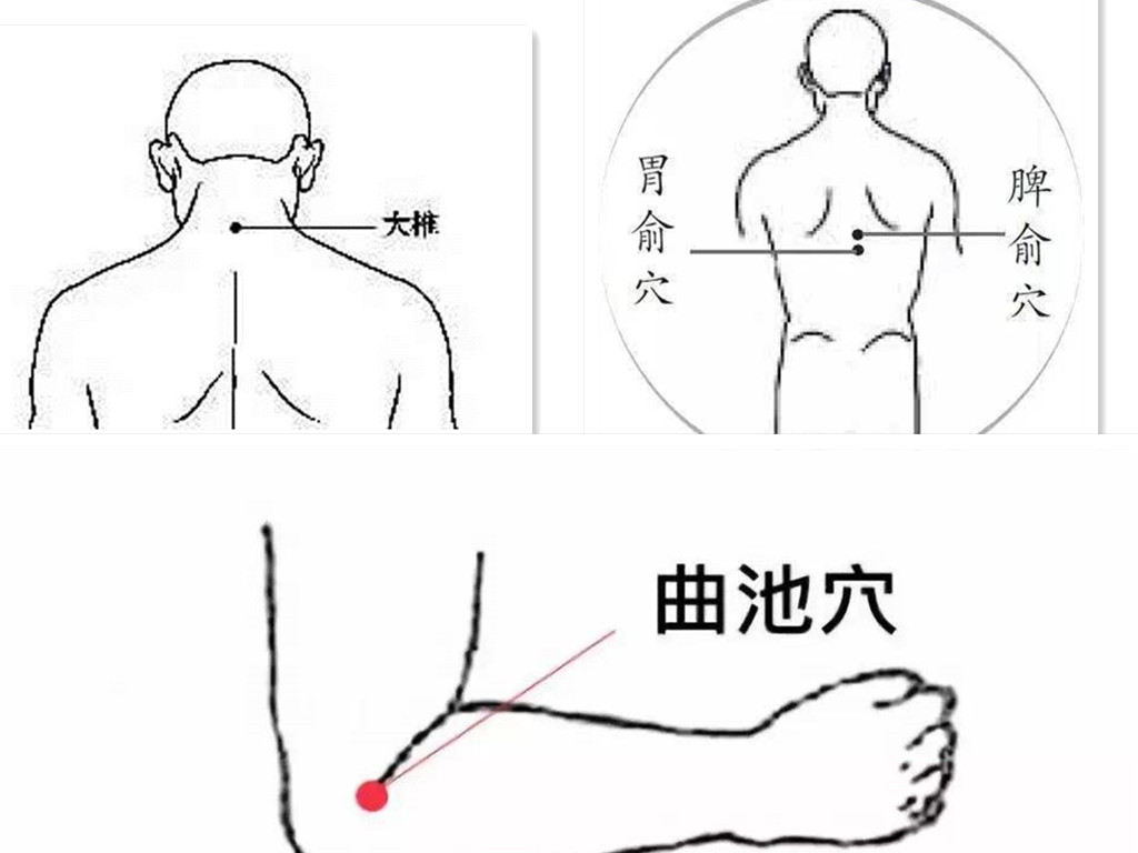 连续上班累成狗小心患上周期性瘫痪——宏世堂今日干货分享