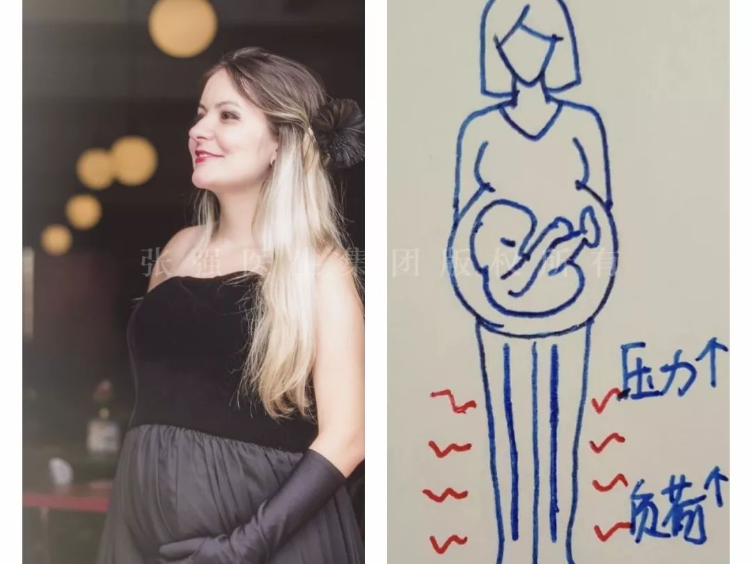 「鼠年“鼠你好孕”」做到这3点，让你轻松应对孕期下肢静脉曲张