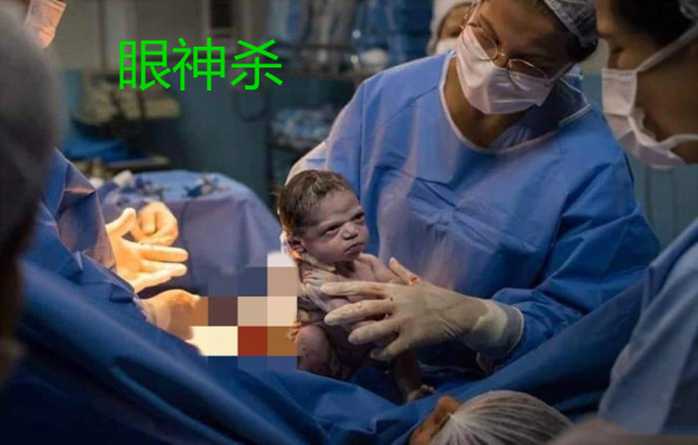 剖腹产宝宝出声表情严肃“眼神”霸气，火了：我就是不哭