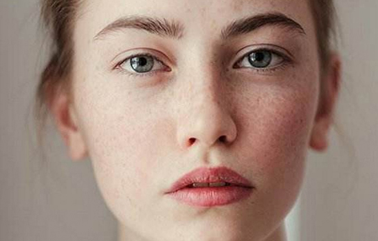 皮肤怎样淡斑,皮肤怎样补水淡斑