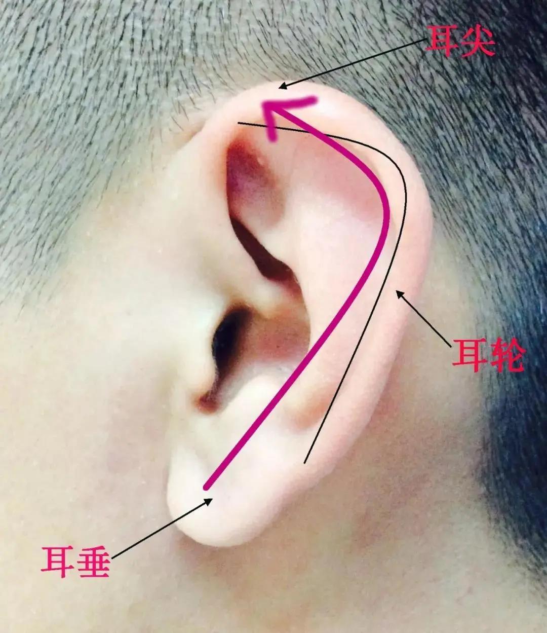 郑芸耳鸣彻底痊愈案例,华西医院郑芸谈脑鸣与耳鸣