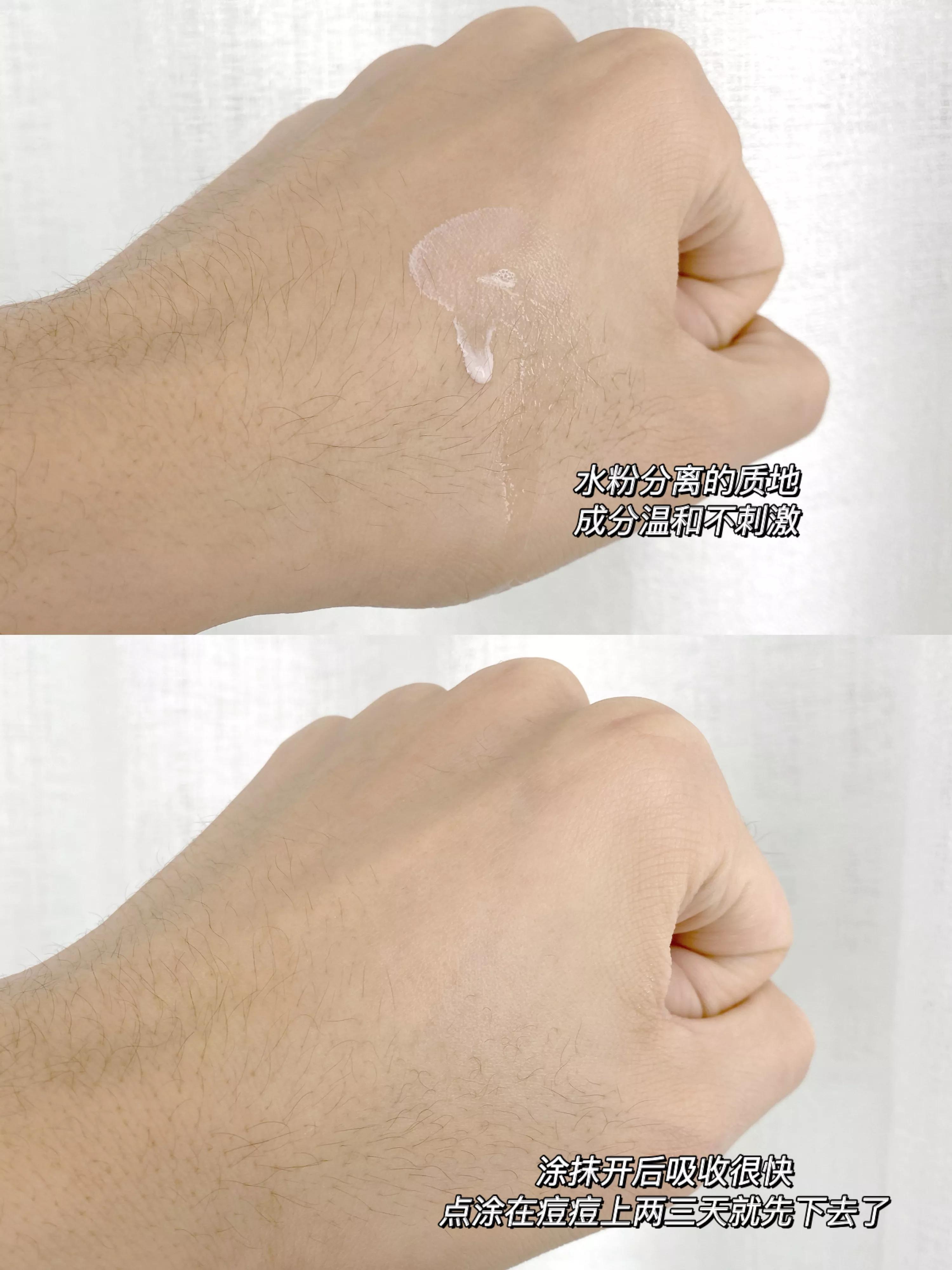 收缩毛孔男士专用精华液,毛孔收缩精华液推荐男士