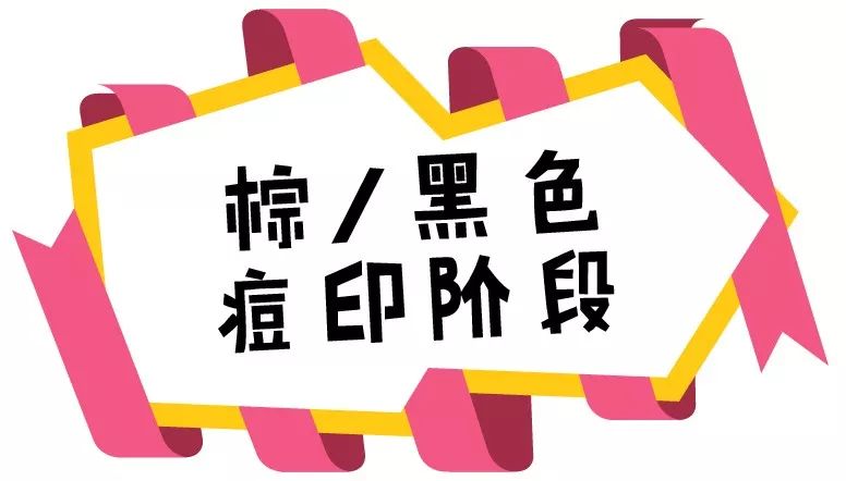 祛除痘印和痘疤的护肤品,正确的护肤方法帮你对抗顽固痘印