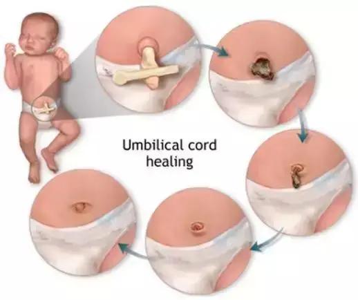 肚脐眼到底能不能抠呢,肚脐眼到底能不能抠小实验
