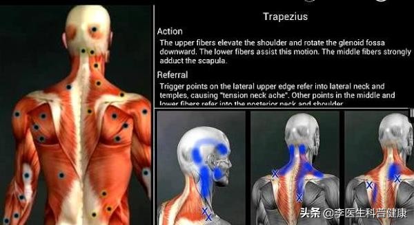 右侧后背僵硬肩胛骨下边疼,右后背肩胛骨下方僵硬是咋回事