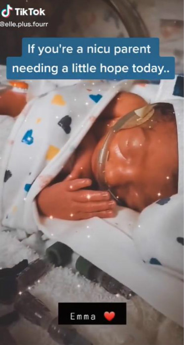 妈妈记录三胞胎一天奶量,三胞胎妈妈喂小宝宝