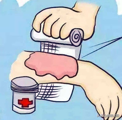 健康科普低温烫伤小视频,低温烫伤科普