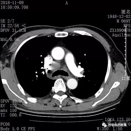 怎么应用统计学做调查,统计学方法可以解决的主要问题