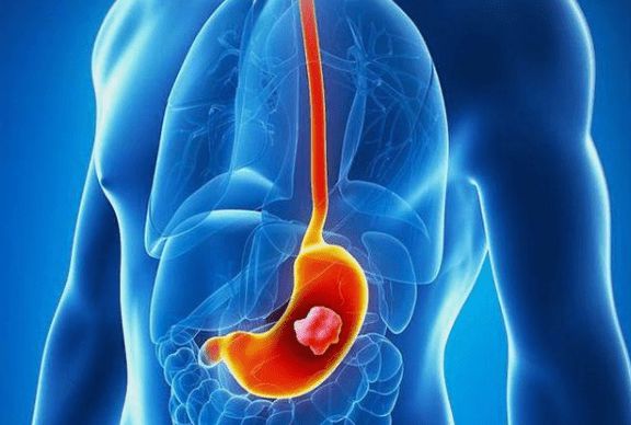 胃不好的人千万别吃山药,三种玉米尽量少吃最好不吃