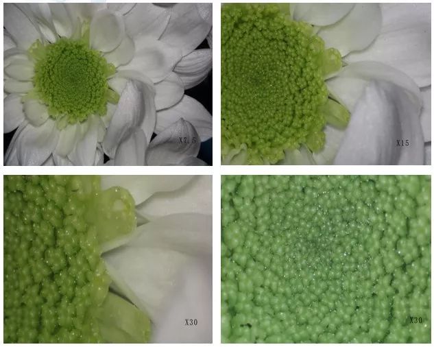 “小手”拉“大手”！顺德宫颈疾病防治再上新台阶