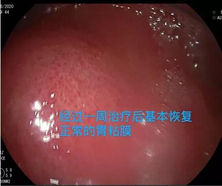 6个月宝宝消化道出血症状,6个月宝宝吐血怎么回事