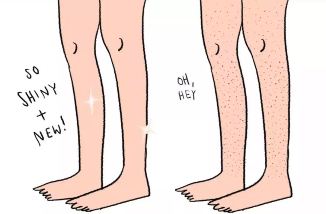 脱毛方法排行榜第一名,目前最好的脱毛技术