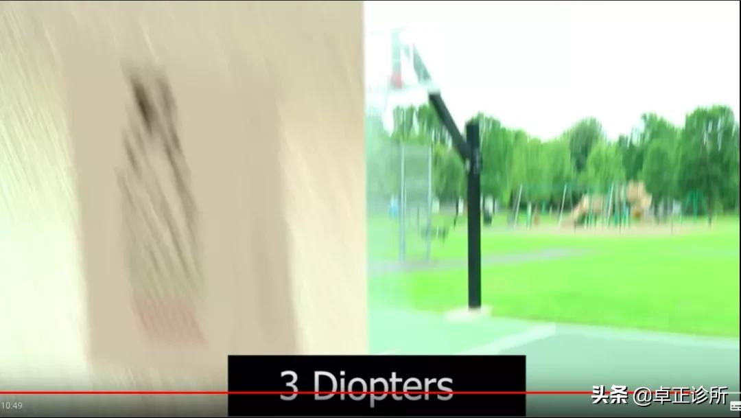 小孩眼睛近视散光怎么改善,眼睛散光近视要怎么改善