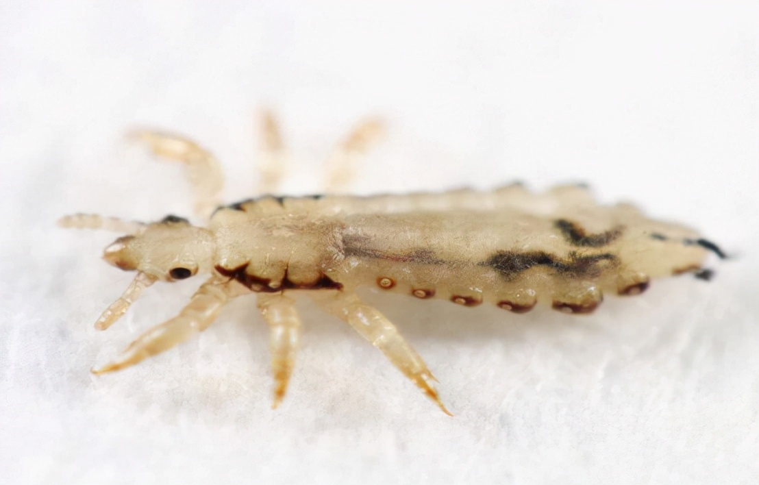 30年前的虱子现在怎么消失了,30年前人为什么都有虱子