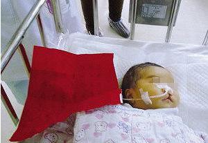 经历了一胎顺产二胎剖腹产又怎样,奉劝准妈妈能顺产不要剖腹产