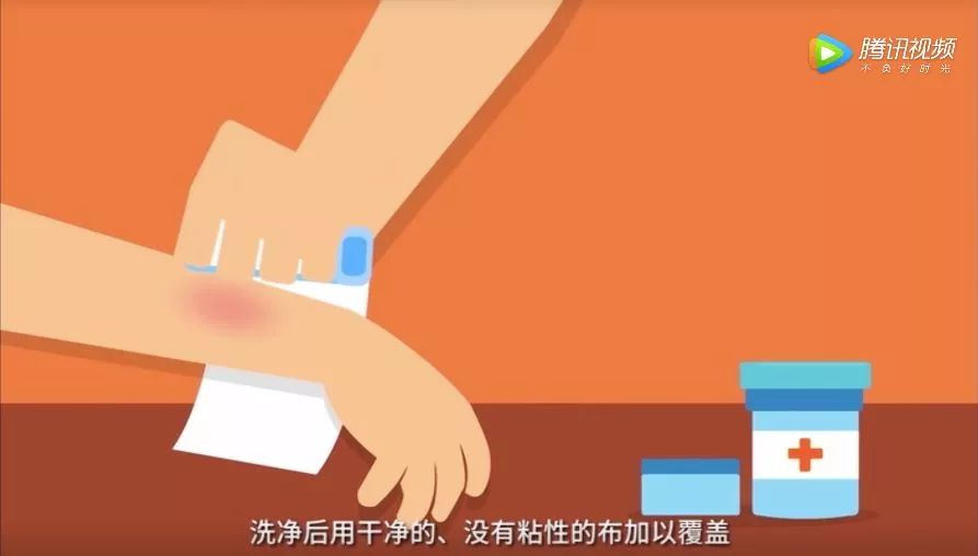 伤害无辜的孩子,伤害手无寸铁的人