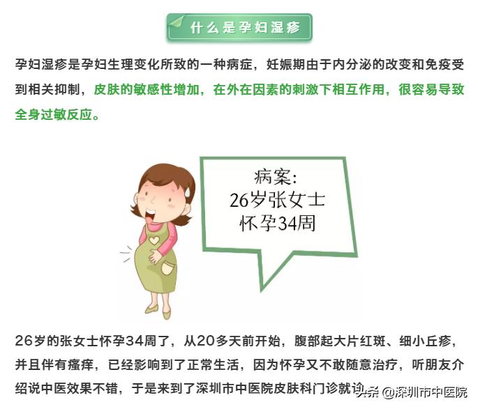 孕期湿疹用什么中药,孕期湿疹中药外洗怎么洗