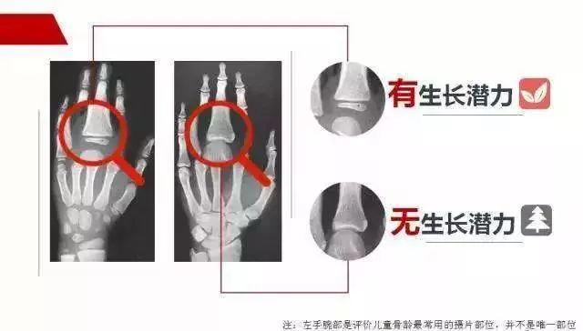 小孩子长不高怎么长高,家长做什么能长高