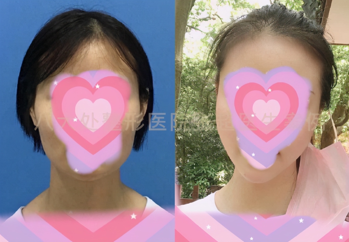 八大处张超抖音,八大处张超合集