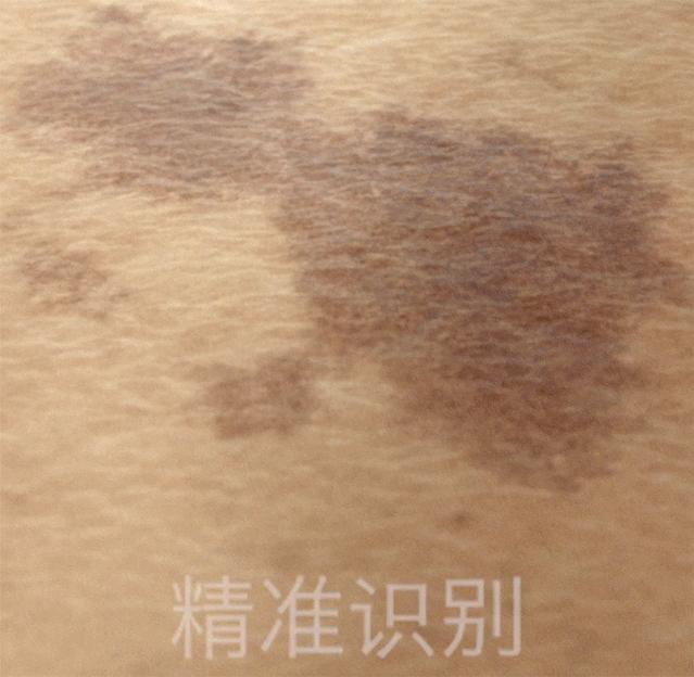 瞬间让脸变白的神器,让斑快速消失