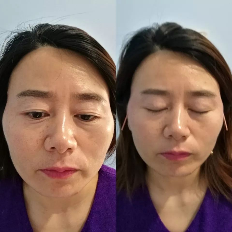 经常敷面膜有什么改善,经常敷面膜皮肤看起来还是很差