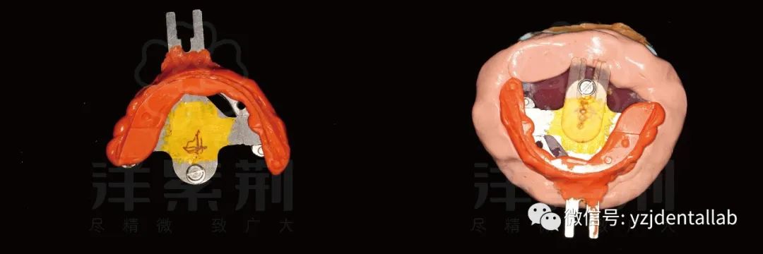 病例教学视频,病例分析操作技能