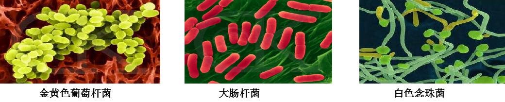 引起女性私密疾病原因有哪些？