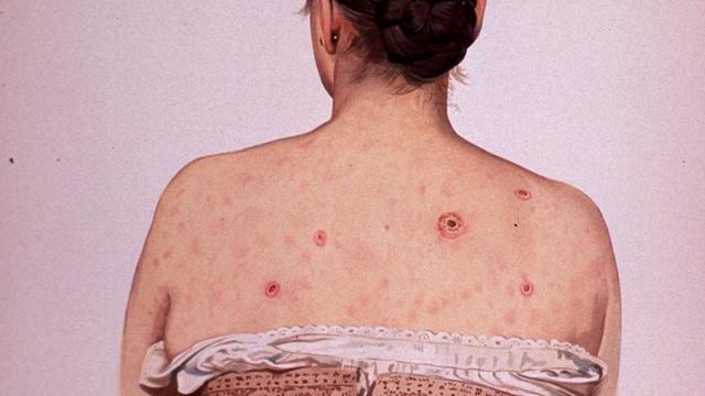 哥伦布：奴隶贩子、残酷剥削者和梅毒传播大使！