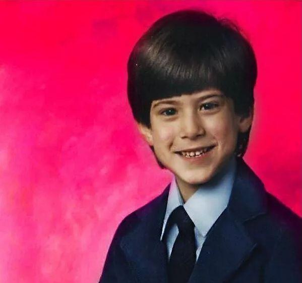 隆胸那些事你真的了解吗,隆胸加腹壁整形