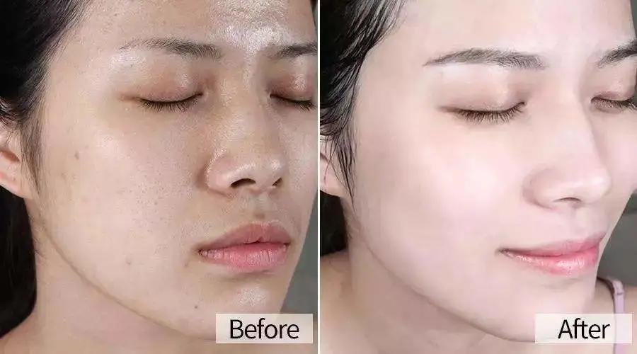 那些学化妆的女孩子后来怎么样了,学医美的女生怎么样