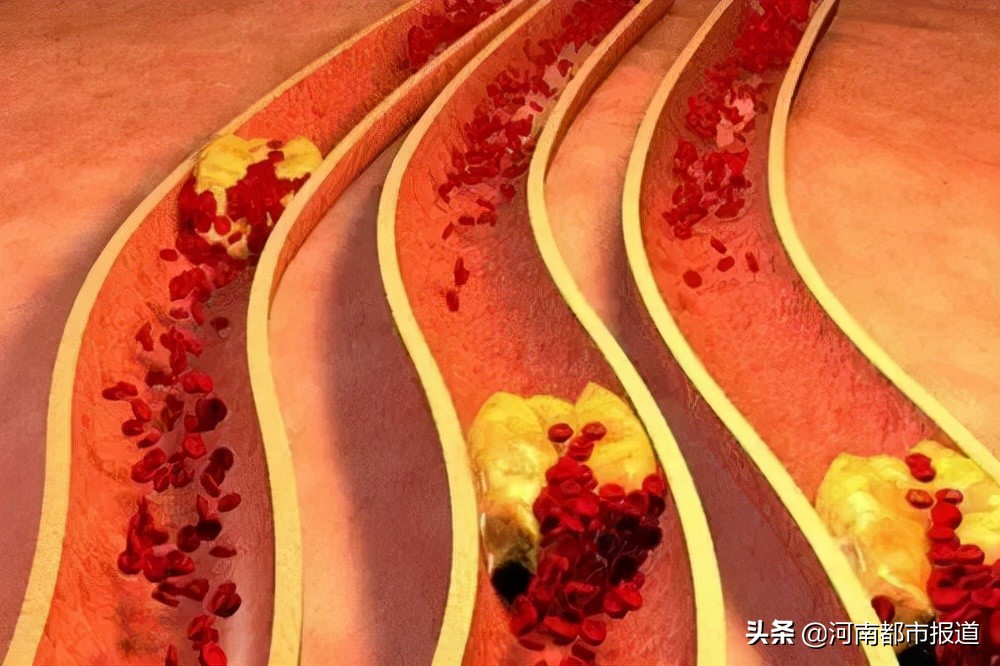 一年晕倒两次怎么恢复,一年内晕倒3次是什么原因