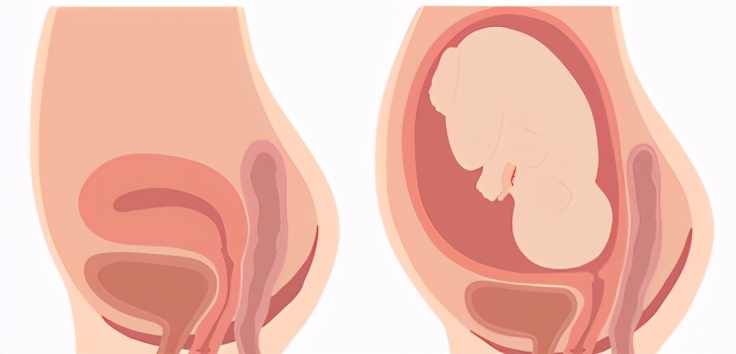 产后说话不清楚是什么原因导致的,产后说不出话怎么回事