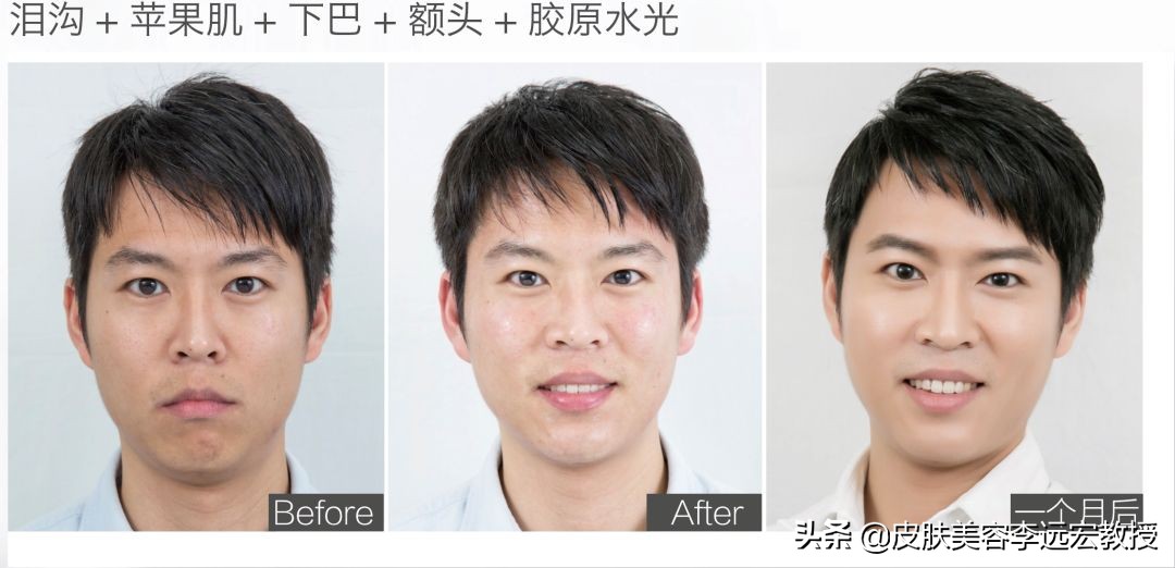 哪种口服胶原蛋白效果好,口服胶原蛋白的骗局