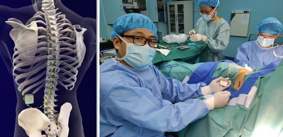 坐骨神经痛是糖尿病引起的吗,被糖尿病并发症吓到