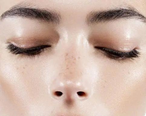 不做黄脸婆告别色斑,不做黄脸婆该怎么做