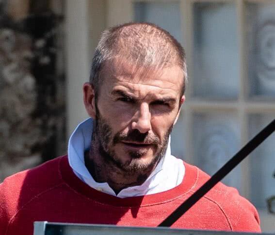 贝克汉姆严重脱发,贝克汉姆脱发原视频