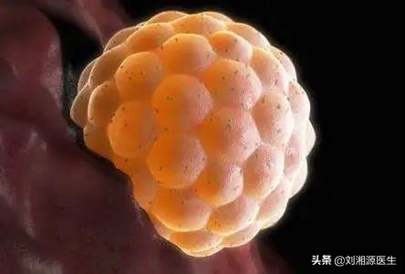 免疫相关不良妊娠答疑解惑,怀孕如何避免强直性脊柱炎